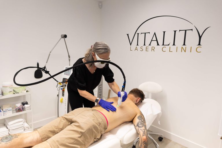 A patient undergoing laser hair removal treatment from Vitality clinic